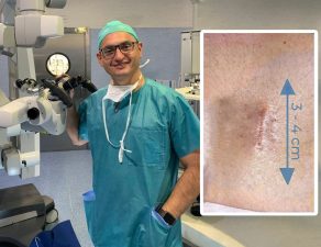Dr. Bernardo Mosqueira performing minimally invasive spinal surgery in Spain, showing the small surgical incision